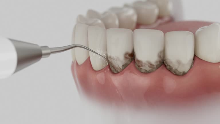 Reliable Dental Implants contractor in Cutten, CA by Smile Center Dentistry